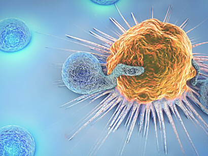 3D render depicting a cancer cell surrounded by lymphocytes, ideal for medical education and visualization