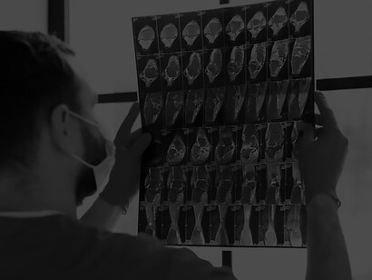 A doctor analyzing a CT scan alongside neuroimaging studies