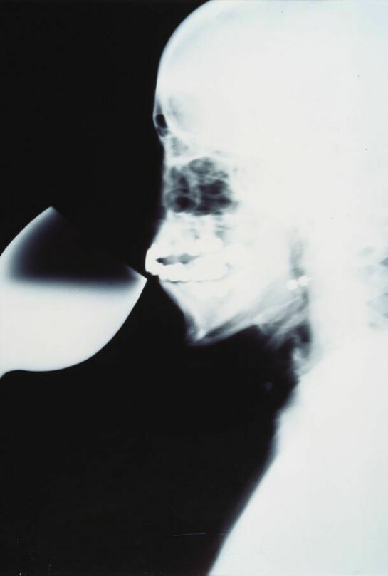 Isa Genzken, X-Ray, 1991. Courtesy Städtische Galerie im Lenbachhaus, Munich. © Isa Genzken.