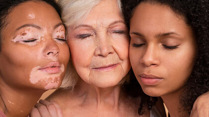 Women of different ages and diverse skin types posing together, celebrating natural beauty and individuality