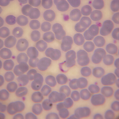«Trypanosoma cruzi»