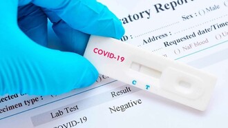 La globalización ha sido la condición de posibilidad de que se produjera la primera pandemia en la historia de la humanidad