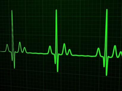 Dopo un episodio sincopale è necessario monitorare il paziente e registrare con la telemetria il tracciato elettrocardiografico in caso di eventuale recidiva sincopale