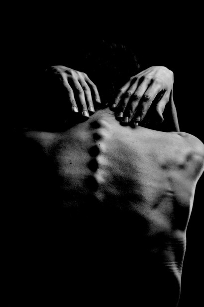 Anorexia y danza