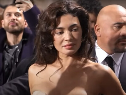 Kylie Jenner was recently spotted on the Gaultier red carpet, sparking discussions about her visibly overfilled facial enhancements