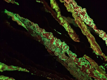 Capsules (detail). Courtesy of Match Gallery