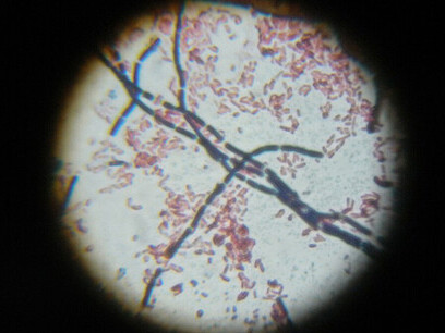 Bacillus cereus y Escherichia coli. Frente a Escherichia coli multirresistente, las terapias con fagos ofrecen una alternativa viable en infecciones urinarias recurrentes