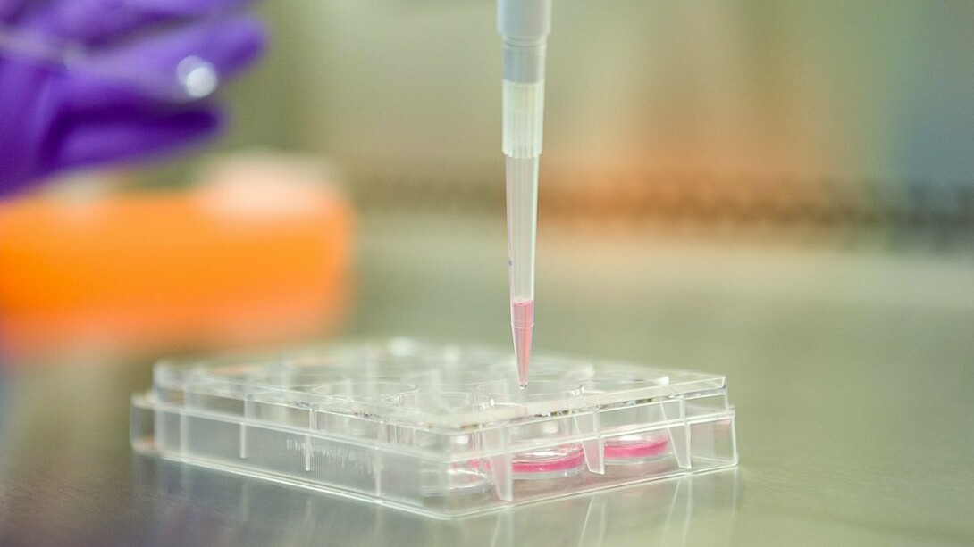 A cell culture plate with induced pluripotent stem cells, the regenerative powerhouses at the heart of innovative therapies, offering hope for chronic joint pain and inflammatory arthritis