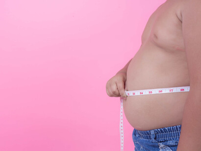Niño con obesidad