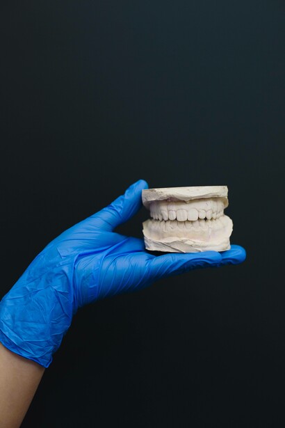 Man holding a jaw impression