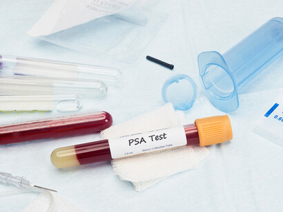 Il PSA Test
