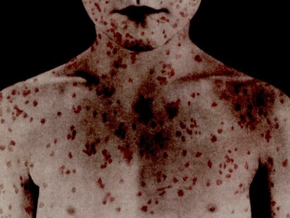 Un movimiento fundamentalista que no tiene más argumentos que los de la fe del carbonero y las teorías de la conspiración