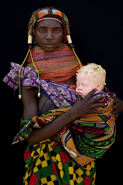 Madre africana con su bebé albino