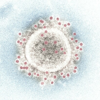 Imagen microscópica electrónica de transmisión (TEM) coloreada digitalmente: resalta la envoltura de partículas de un solo virión coronavirus del síndrome respiratorio del Medio Oriente (MERS-CoV) 