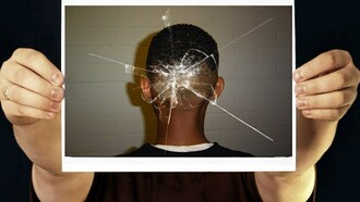 Fotografía de una cabeza con la marca de un cristal roto por un disparo