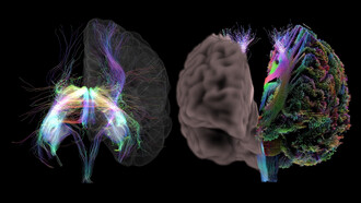 Modelos del cerebro humano desarrollados por el Human Brain Project