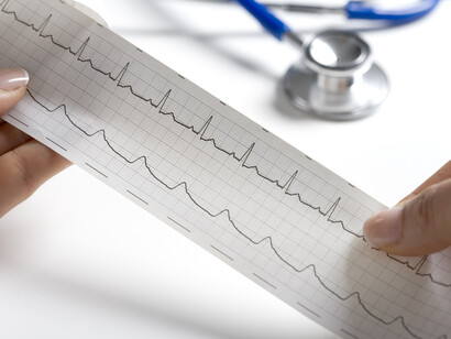 La frequenza cardiaca è un fattore di rischio cardiovascolare