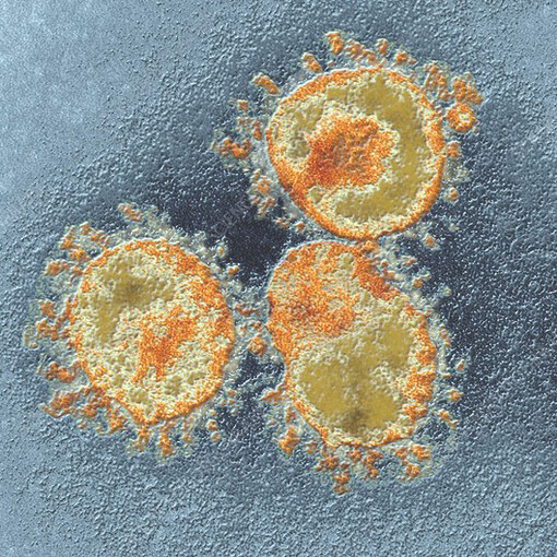 SARS-CoV-2