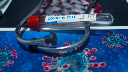 The SARS-CoV-2 has met the two basic definitions of a pandemic