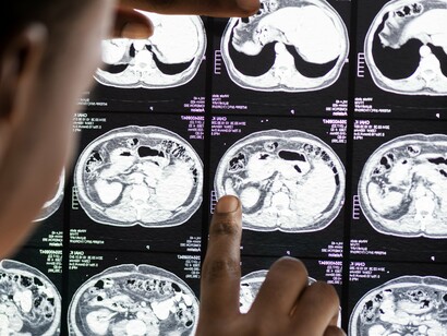 A technological snapshot of the brain that cannot account for consciousness alone