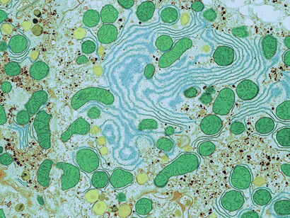 Células humanas vistas bajo el microscopio