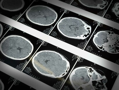 L’emisfero destro è analogico e analitico ed è preposto a tutte le attività motorie e spaziali