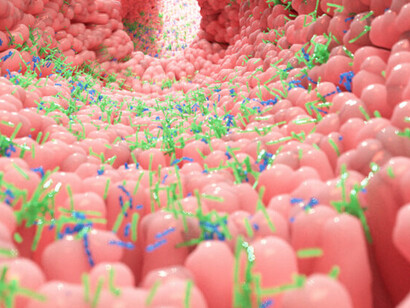 Microbiota intestinale: bisogna limitare invece, il consumo dei cibi grassi, contenenti zuccheri raffinati e poco sani