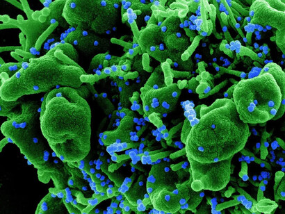 La humanidad durante los dos últimos siglos, sin distingo social, económico, ideológico o religioso que tenga, no había estado bajo tanto riesgo como ha sucedido con esta pandemia