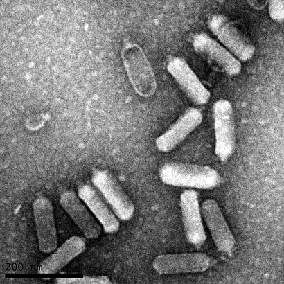 Microscopia elettronica a trasmissione di Escherichia phage vB_EcoP_SU10 (Kuravirus SU10, podovirus C3) con colorazione negativa. La lunghezza della testa misurata è di 137±4,2 nm. Di Mohammadali Khan Mirzaei, Harald Eriksson, Kie Kasuga, Elisabeth Haggård-Ljungquist, Anders S. Nilsson
