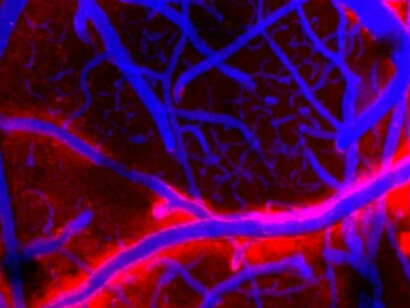 La diferencia de flujo de líquido cefalorraquídeo que se observa en el cerebro de un ratón despierto y dormido